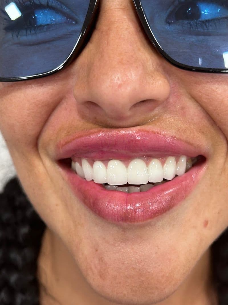 Stomatolog Novi Sad - TANJA DENTIST — gallery 2