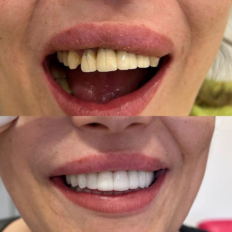 Stomatolog Novi Sad - TANJA DENTIST — gallery 4