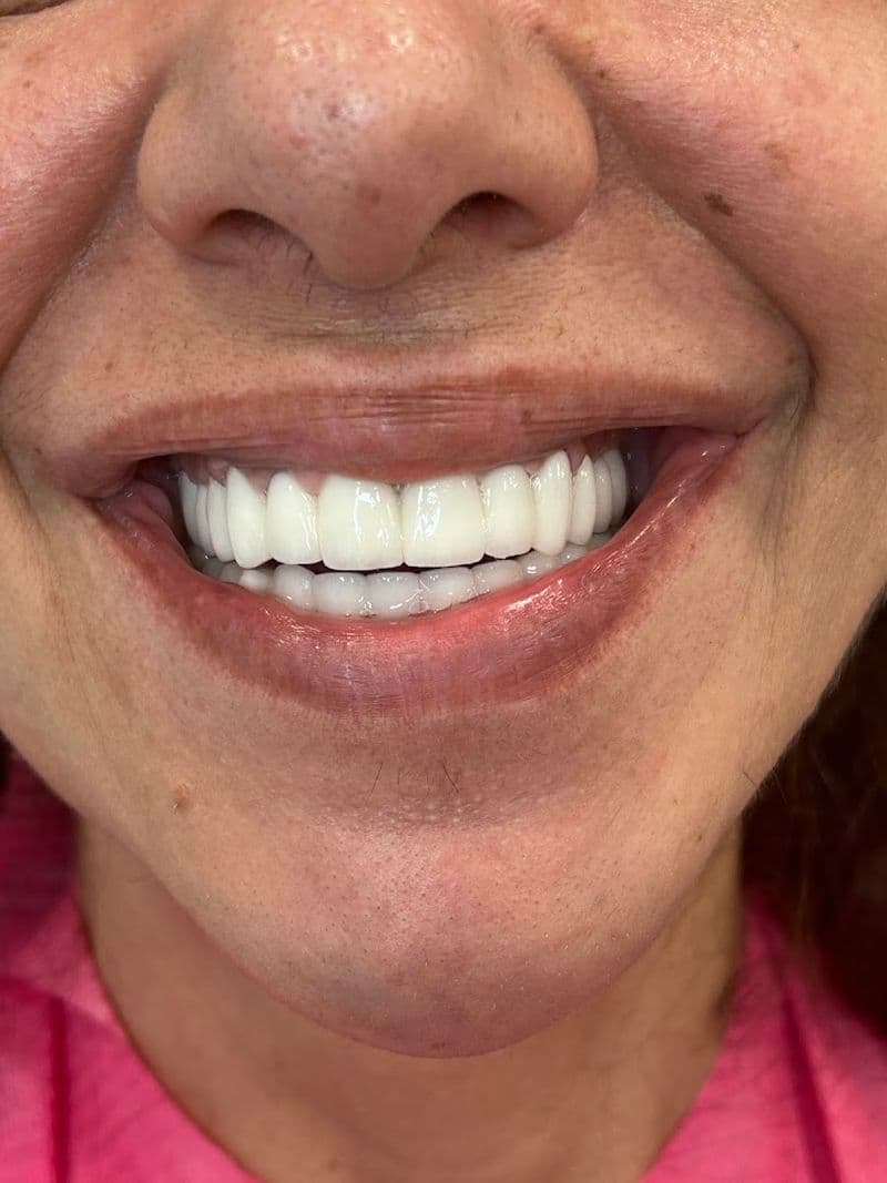 Stomatolog Novi Sad - TANJA DENTIST — gallery 5