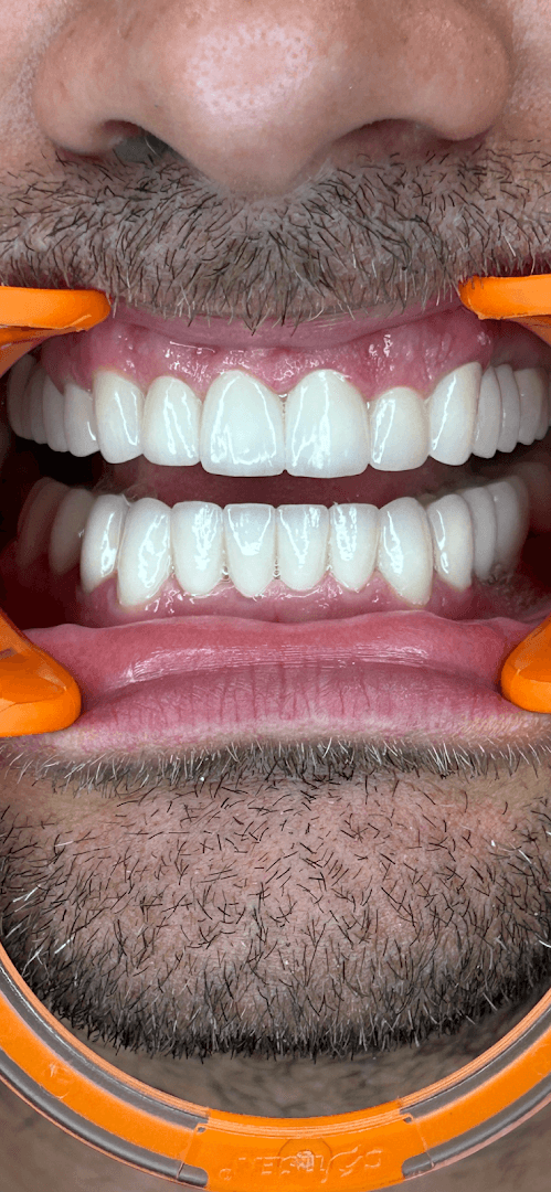 Stomatolog Novi Sad - TANJA DENTIST — hero image